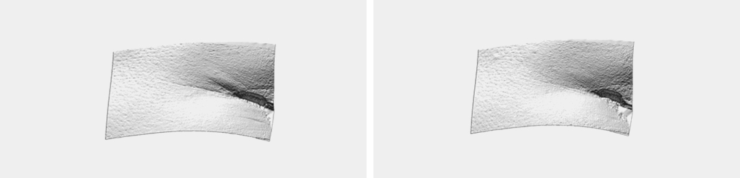 피부 주름 예시이미지