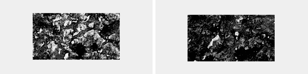 ※ 각질화정도 예시이미지